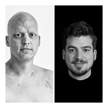 Voor/na